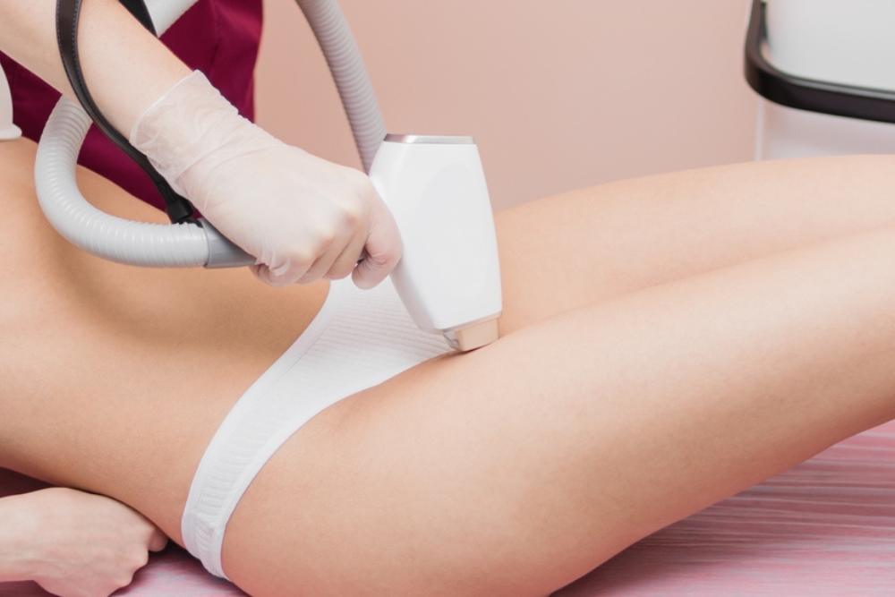 Αποτρίχωση με laser μπικίνι